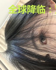 全球降临：荒岛求生