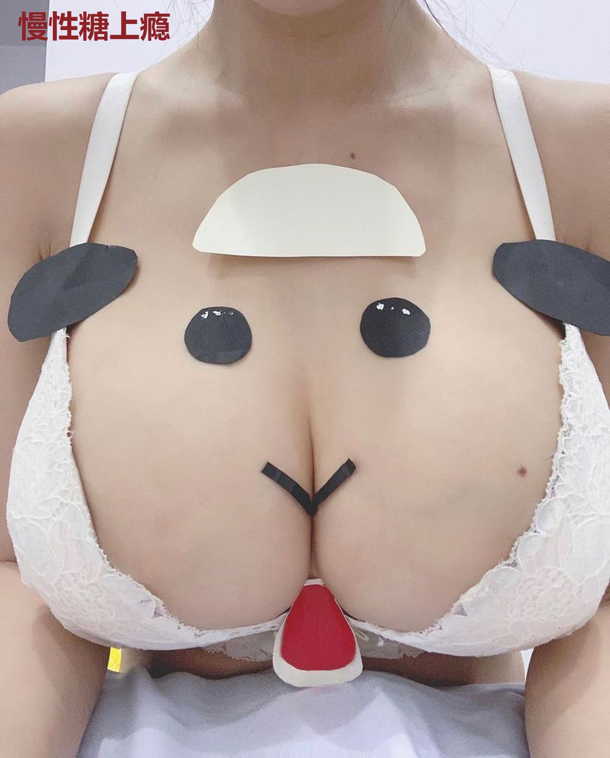 慢性糖上瘾